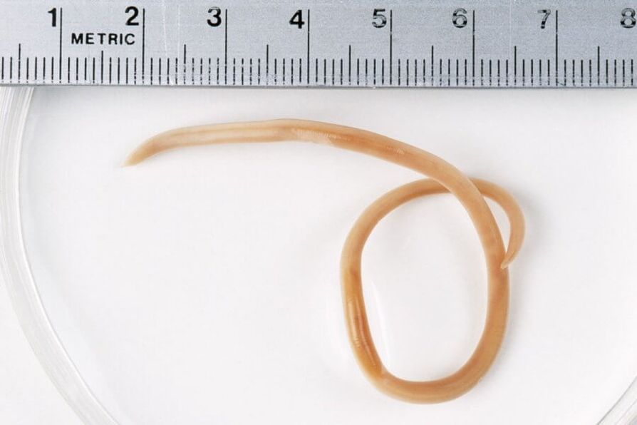 pinworm no cilvēka ķermeņa