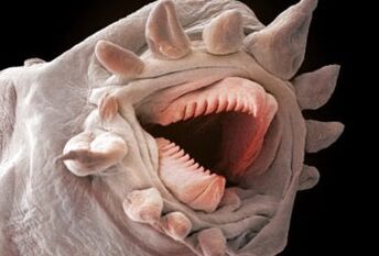 kādi tārpi var dzīvot cilvēka organismā